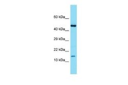 ATP6V1G3 Antibody, Novus Biologicals 100 &mu;L | Buy Online | Novus Biologicals | Fisher Scientific